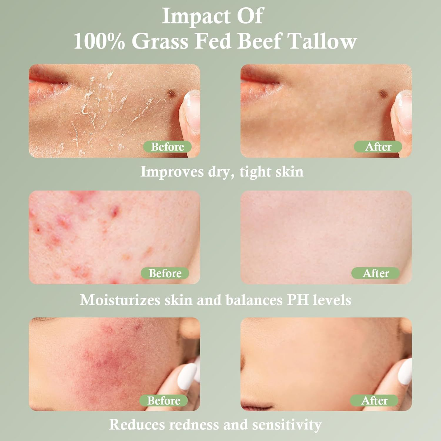 Grass-Fed Tallow Hydrating Cream